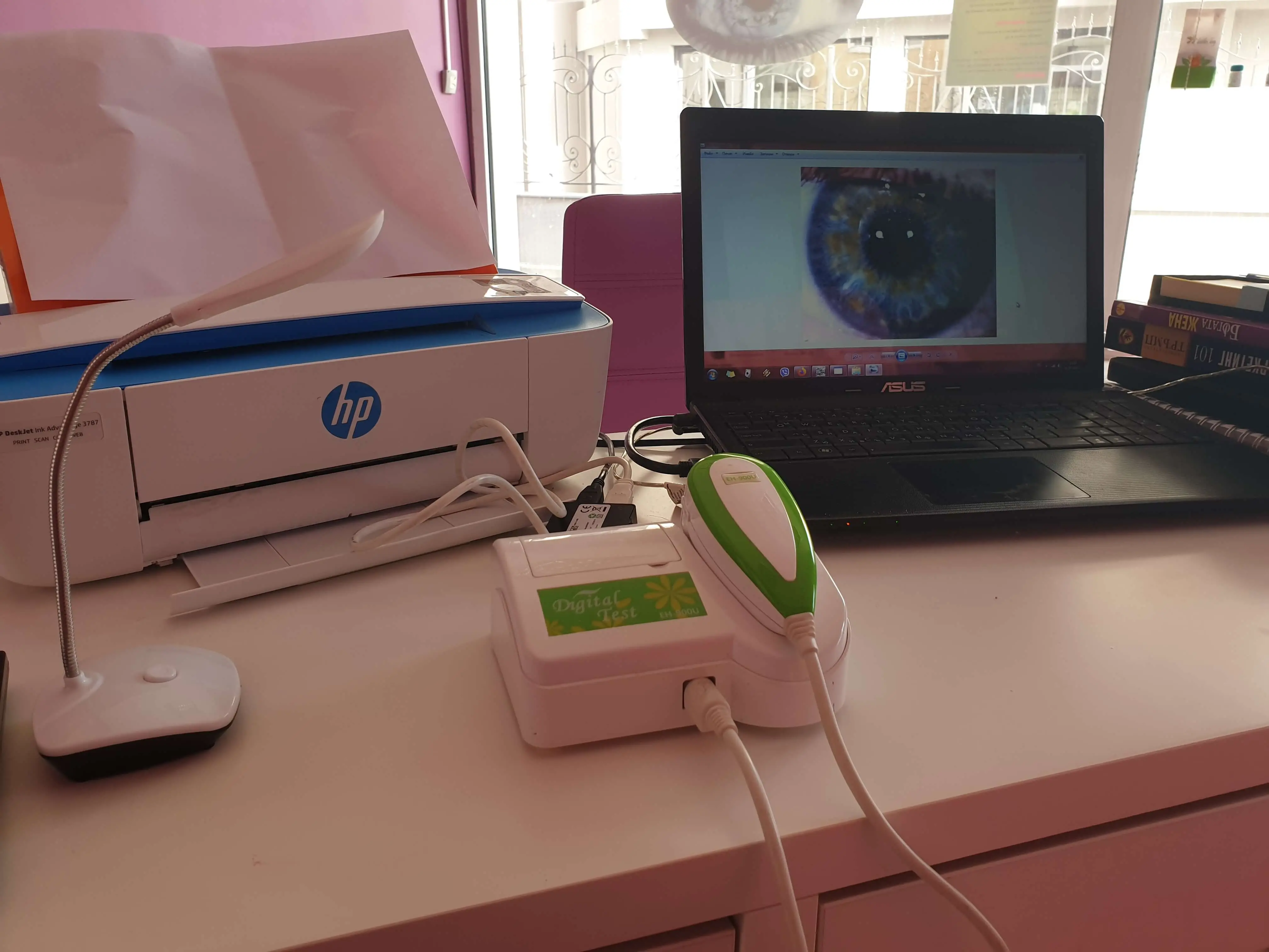 Разчитане на снимките на ирисите от ирисолога